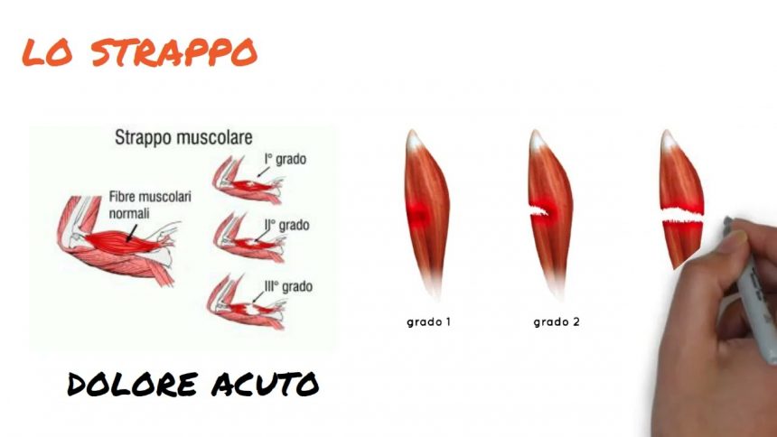 Come si cura uno strappo muscolare? Fisioterapia Genova